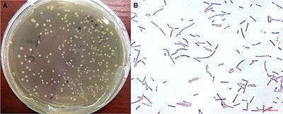 Novel Lactobacillus reuteri HI120 Affects Lipid Metabolism in C57BL/6 Obese Mice